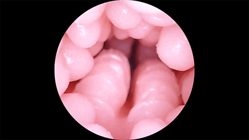 Hình ảnh lõi âm đạo co bóp ở bên trong