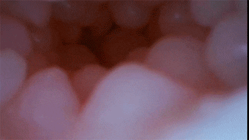 Cấu tạo bên trong ngoài những gai nhỏ li ti, sự gồ ghề 