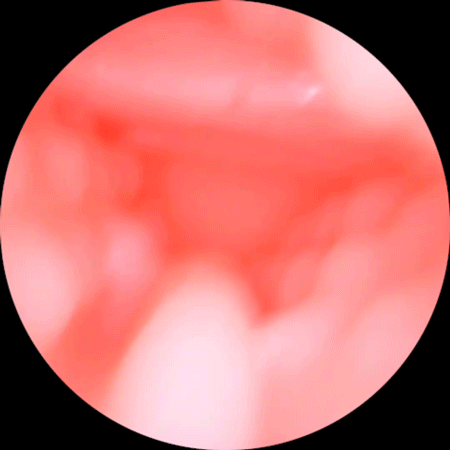 Lõi có gai nhỏ tăng thêm khoái cảm