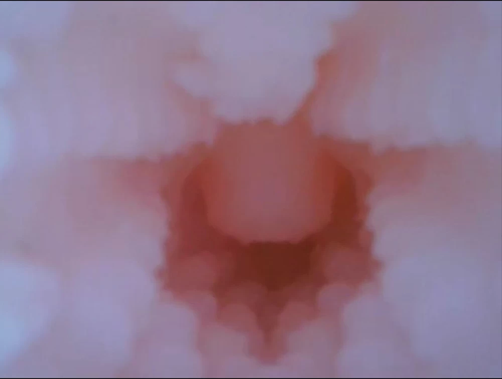 Nhiều đường gân tăng kích thích