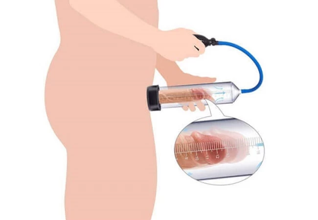 Máy tập dương vật nâng cao khả năng cương dương