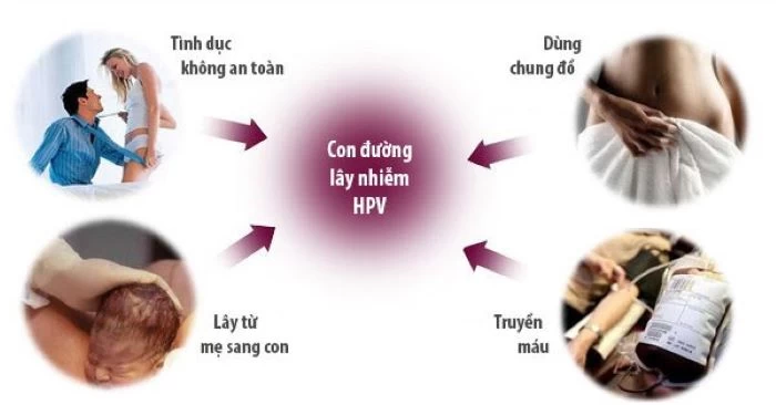HPV là virus nguy hiểm, có thể lây nhiễm qua nhiều con đường 