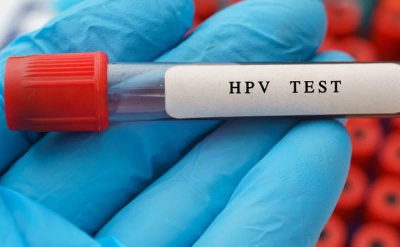 Xét nghiệm HPV giúp phát hiện bệnh sớm