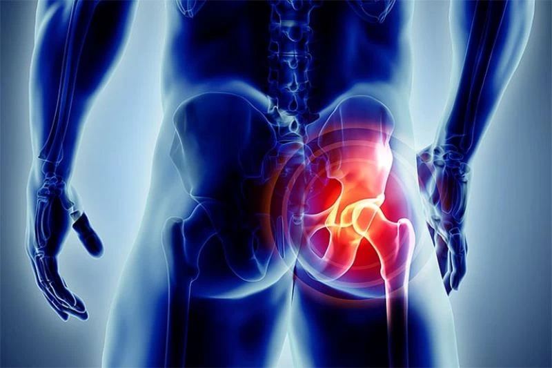 Phẫu thuật vùng chậu đến xuất tinh khô