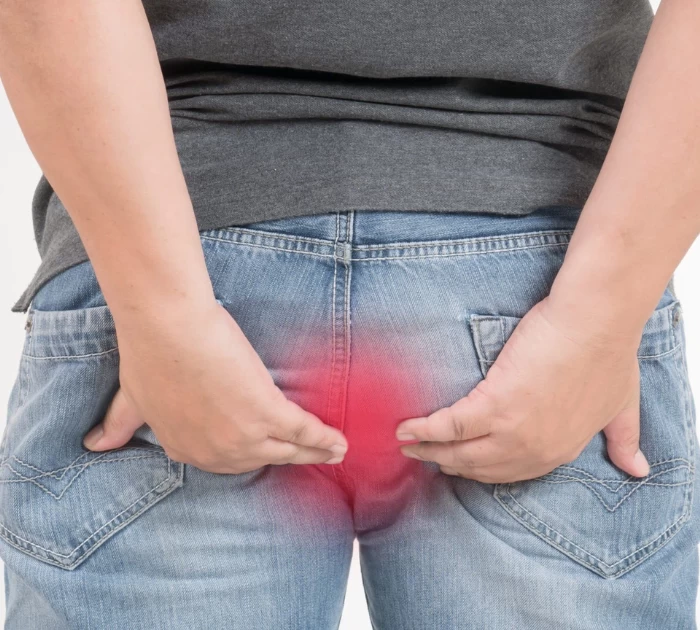 mỗ trĩ bao lâu có quan hệ