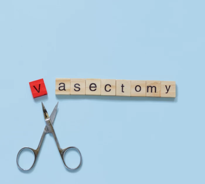 thắt ống dẫn tinh