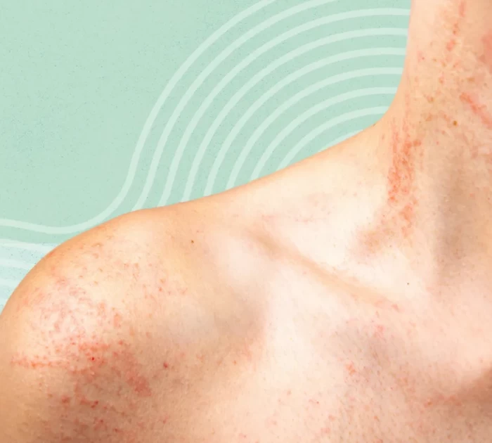 Khi nào thì nên quan tâm tới sức khoẻ