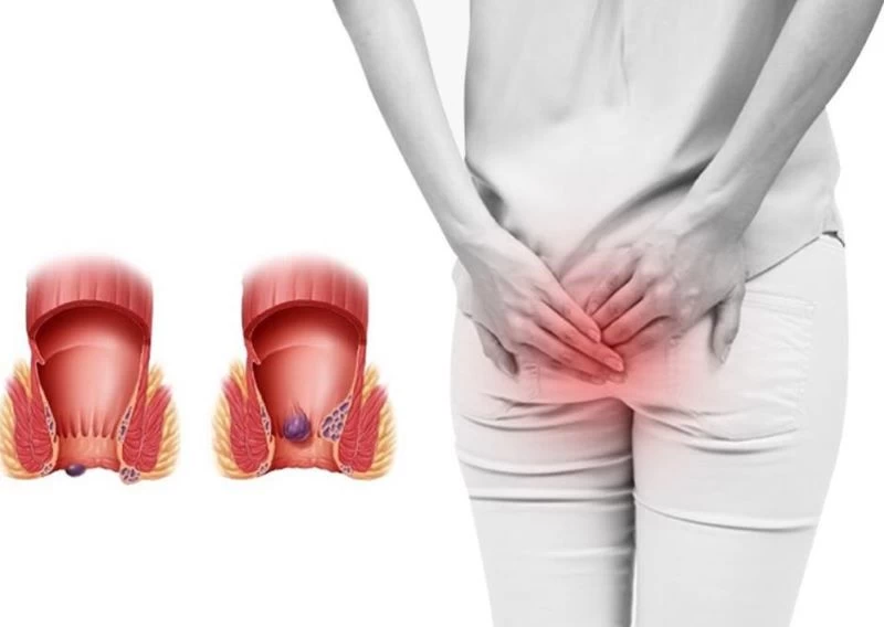 Hậu môn và vùng bụng chịu áp lực khi quan hệ