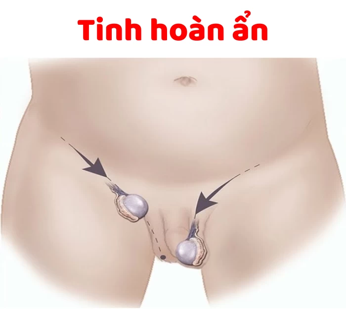 Nguyên nhân dậy thì muộn ở cả nam và nữ
