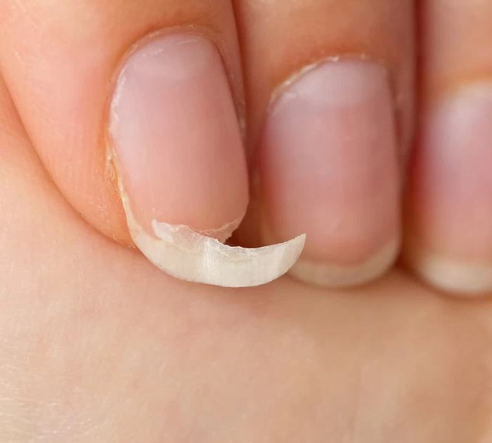  Dấu hiệu nhận biết cơ thể bị thiếu kẽm