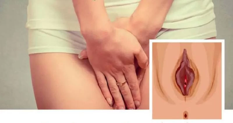 Kem làm sáng vùng kín dịu nhẹ, an toàn