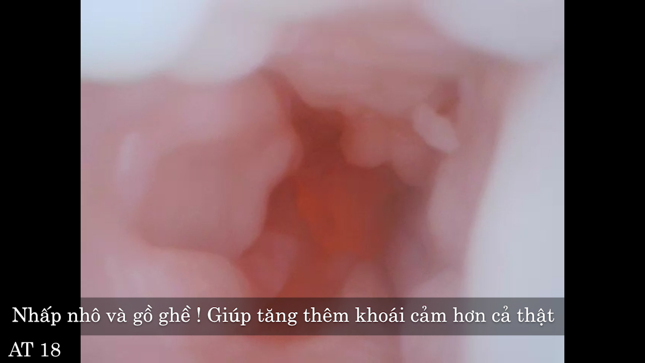 Fox Weyes có âm hộ giả mô phỏng như của phụ nữ thật