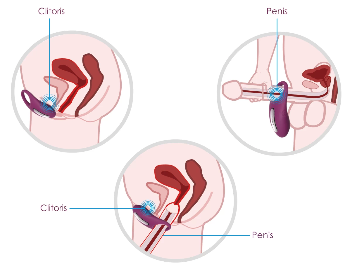 cách đeo vòng đeo cu - Oichin